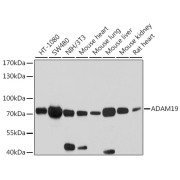 Western blot analysis of various lysates using ADAM19 Antibody at 1/2000 dilution. Secondary antibody: HRP-conjugated Goat anti-Rabbit IgG (H+L) at 1/10000 dilution. Lysates/proteins: 25 µg per lane. Blocking buffer: 3% nonfat dry milk in TBST. Exposure time: 30s.