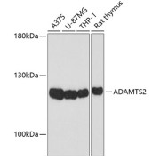 Western blot analysis of various lysates using ADAMTS2 Antibody at 1/1000 dilution. Secondary antibody: HRP-conjugated Goat anti-Rabbit IgG (H+L) at 1/10000 dilution. Lysates/proteins: 25 µg per lane. Blocking buffer: 3% nonfat dry milk in TBST. Exposure time: 30s.