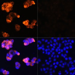 Alpha-Fetoprotein (AFP) Antibody