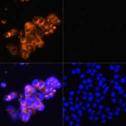 Alpha-Fetoprotein (AFP) Antibody