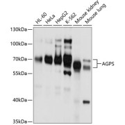 Western blot analysis of various lysates using AGPS Antibody at 1/1000 dilution. Secondary antibody: HRP-conjugated Goat anti-Rabbit IgG (H+L) at 1/10000 dilution. Lysates/proteins: 25 µg per lane. Blocking buffer: 3% nonfat dry milk in TBST. Exposure time: 5s.