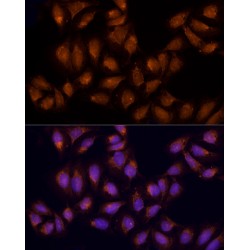 Alkylglycerone Phosphate Synthase (AGPS) Antibody