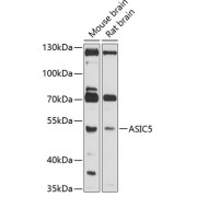 Western blot analysis of various lysates using ASIC5 Antibody at 1/1000 dilution. Secondary antibody: HRP-conjugated Goat anti-Rabbit IgG (H+L) at 1/10000 dilution. Lysates/proteins: 25 µg per lane. Blocking buffer: 3% nonfat dry milk in TBST. Exposure time: 30s.