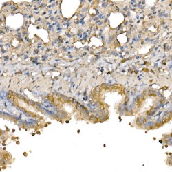 Bcl2 Associated X Protein (BAX) Antibody