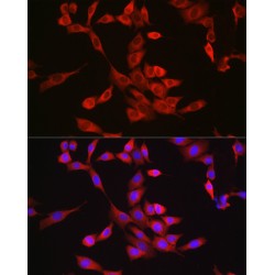 Bcl2 Associated X Protein (BAX) Antibody