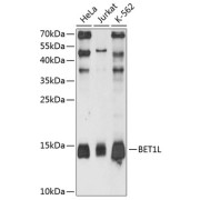 Western blot analysis of various lysates using BET1L Antibody at 1/3000 dilution. Secondary antibody: HRP-conjugated Goat anti-Rabbit IgG (H+L) at 1/10000 dilution. Lysates/proteins: 25 µg per lane. Blocking buffer: 3% nonfat dry milk in TBST. Exposure time: 90s.