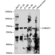 Western blot analysis of various lysates using CABLES1 Antibody at 1/1000 dilution. Secondary antibody: HRP-conjugated Goat anti-Rabbit IgG (H+L) at 1/10000 dilution. Lysates/proteins: 25 µg per lane. Blocking buffer: 3% nonfat dry milk in TBST. Exposure time: 10s.