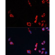 Immunofluorescence analysis of HeLa cells using Caspase-10 Antibody at dilution of 1/100 (40x lens). Secondary antibody: Cy3-conjugated Goat anti-Rabbit IgG (H+L) at 1/500 dilution. Blue: DAPI for nuclear staining.