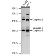 Immunohistochemistry analysis of paraffin-embedded Mouse kidney tissue using Caspase-9 Antibody at a dilution of 1/300 (40x lens). High pressure antigen retrieval was performed in 0.01 M citrate buffer (pH 6.0) prior to IHC staining.