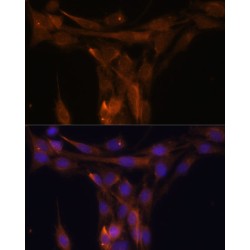 Caspase 9 (CASP9) Antibody