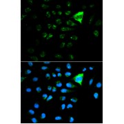 Immunohistochemistry analysis of paraffin-embedded Mouse liver tissue using CDKN1A/p21CIP1 Antibody at a dilution of 1/100 (40x lens). Microwave antigen retrieval was performed in 0.01 M PBS buffer (pH 7.2±0.2) prior to IHC staining.