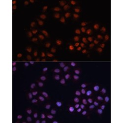 Cyclin Dependent Kinase Inhibitor 1A (CDKN1A) Antibody