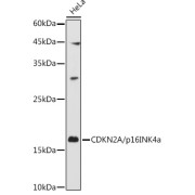 Immunoprecipitation analysis of 200 µg extracts of 293T cells, using 3 µg CDKN2A/p16INK4a antibody. Western blot was performed from the immunoprecipitate using CDKN2A/p16INK4a antibody at a dilution of 1/1000.