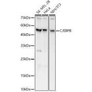 Western blot analysis of various lysates, using C/EBPB Antibody at 1/700 dilution. Secondary antibody: HRP-conjugated Goat anti-Rabbit IgG (H+L) at 1/10000 dilution. Lysates/proteins: 25 µg per lane. Blocking buffer: 3% nonfat dry milk in TBST. Exposure time: 1s.