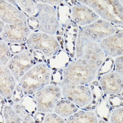 CCAAT/Enhancer Binding Protein Beta (CEBPB) Antibody