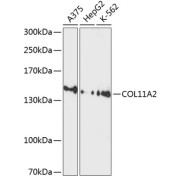 Western blot analysis of various lysates using COL11A2 Antibody at 1/1000 dilution. Secondary antibody: HRP-conjugated Goat anti-Rabbit IgG (H+L) at 1/10000 dilution. Lysates/proteins: 25 µg per lane. Blocking buffer: 3% nonfat dry milk in TBST. Exposure time: 90s.