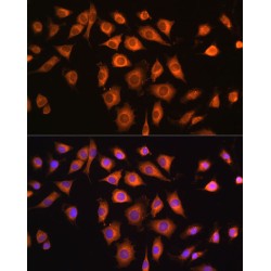 Coatomer Protein Complex Subunit Zeta 1 (COPZ1) Antibody