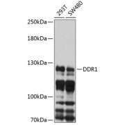 Western blot analysis of various lysates using DDR1 Antibody at 1/1000 dilution. Secondary antibody: HRP-conjugated Goat anti-Rabbit IgG (H+L) at 1/10000 dilution. Lysates/proteins: 25 µg per lane. Blocking buffer: 3% nonfat dry milk in TBST. Exposure time: 5s.