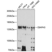 Western blot analysis of various lysates using DIAPH3 Antibody at 1/1000 dilution. Secondary antibody: HRP-conjugated Goat anti-Rabbit IgG (H+L) at 1/10000 dilution. Lysates/proteins: 25 µg per lane. Blocking buffer: 3% nonfat dry milk in TBST. Exposure time: 90s.