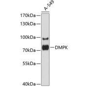 Western blot analysis of lysates from A-549 cells, using DMPK Antibody at 1/1000 dilution. Secondary antibody: HRP-conjugated Goat anti-Rabbit IgG (H+L) at 1/10000 dilution. Lysates/proteins: 25 µg per lane. Blocking buffer: 3% nonfat dry milk in TBST. Exposure time: 5s.