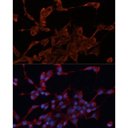 DnaJ (Hsp40) Homolog, Subfamily A, Member 1 (DNAJA1) Antibody