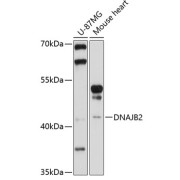 Western blot analysis of various lysates using DNAJB2 Antibody at 1/1000 dilution. Secondary antibody: HRP-conjugated Goat anti-Rabbit IgG (H+L) at 1/10000 dilution. Lysates/proteins: 25 µg per lane. Blocking buffer: 3% nonfat dry milk in TBST. Exposure time: 30s.