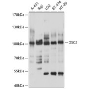 Western blot analysis of various lysates using DSC2 Antibody at 1/1000 dilution. Secondary antibody: HRP-conjugated Goat anti-Rabbit IgG (H+L) at 1/10000 dilution. Lysates/proteins: 25 µg per lane. Blocking buffer: 3% nonfat dry milk in TBST. Exposure time: 5s.