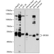 Western blot analysis of various lysates using EIF2B3 Antibody at 1/1000 dilution. Secondary antibody: HRP-conjugated Goat anti-Rabbit IgG (H+L) at 1/10000 dilution. Lysates/proteins: 25 µg per lane. Blocking buffer: 3% nonfat dry milk in TBST. Exposure time: 10s.