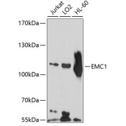 Western blot analysis of various lysates using EMC1 Antibody at 1/1000 dilution. Secondary antibody: HRP-conjugated Goat anti-Rabbit IgG (H+L) at 1/10000 dilution. Lysates/proteins: 25 µg per lane. Blocking buffer: 3% nonfat dry milk in TBST. Exposure time: 90s.