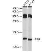 Western blot analysis of various lysates using ERH Antibody at 1/3000 dilution. Secondary antibody: HRP-conjugated Goat anti-Rabbit IgG (H+L) at 1/10000 dilution. Lysates/proteins: 25 µg per lane. Blocking buffer: 3% nonfat dry milk in TBST. Exposure time: 90s.