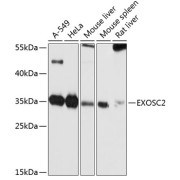 Western blot analysis of various lysates using EXOSC2 Antibody at 1/1000 dilution. Secondary antibody: HRP-conjugated Goat anti-Rabbit IgG (H+L) at 1/10000 dilution. Lysates/proteins: 25 µg per lane. Blocking buffer: 3% nonfat dry milk in TBST. Exposure time: 5s.