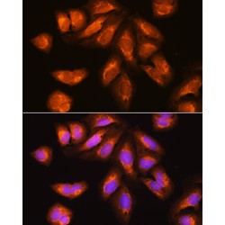 Exosome Component 2 (EXOSC2) Antibody