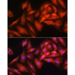 Exosome Component 2 (EXOSC2) Antibody