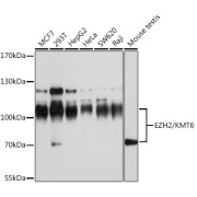 Western blot analysis of various lysates using EZH2/KMT6 Antibody at 1/1000 dilution. Secondary antibody: HRP-conjugated Goat anti-Rabbit IgG (H+L) at 1/10000 dilution. Lysates/proteins: 25 µg per lane. Blocking buffer: 3% nonfat dry milk in TBST. Exposure time: 30s.