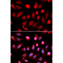 Histone-Lysine N-Methyltransferase EZH2 (EZH2) Antibody