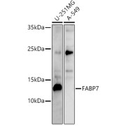 Western blot analysis of various lysates using FABP7 Antibody at 1/500 dilution. Secondary antibody: HRP-conjugated Goat anti-Rabbit IgG (H+L) at 1/10000 dilution. Lysates/proteins: 25 µg per lane. Blocking buffer: 3% nonfat dry milk in TBST. Exposure time: 180s.