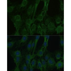 Fatty Acid Binding Protein 7, Brain (FABP7) Antibody