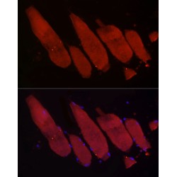 F-Box Protein 32 (FBXO32) Antibody