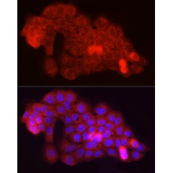 F-Box Protein 32 (FBXO32) Antibody