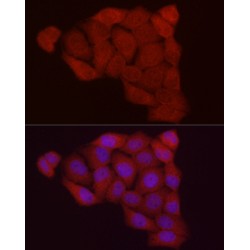 F-Box Protein 32 (FBXO32) Antibody