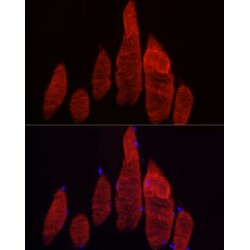 F-Box Protein 32 (FBXO32) Antibody