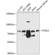 Western blot analysis of various lysates using FCRL3 Antibody at 1/1000 dilution. Secondary antibody: HRP-conjugated Goat anti-Rabbit IgG (H+L) at 1/10000 dilution. Lysates/proteins: 25 µg per lane. Blocking buffer: 3% nonfat dry milk in TBST. Exposure time: 30s.