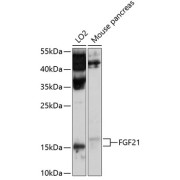 Western blot analysis of various lysates using FGF21 Antibody at 1/1000 dilution. Secondary antibody: HRP-conjugated Goat anti-Rabbit IgG (H+L) at 1/10000 dilution. Lysates/proteins: 25 µg per lane. Blocking buffer: 3% nonfat dry milk in TBST. Exposure time: 90s.