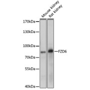 Western blot analysis of various lysates, using FZD6 Antibody at 1/1000 dilution. Secondary antibody: HRP-conjugated Goat anti-Rabbit IgG (H+L) at 1/10000 dilution. Lysates/proteins: 25 µg per lane. Blocking buffer: 3% nonfat dry milk in TBST. Exposure time: 10s.