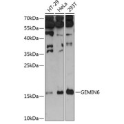 Western blot analysis of various lysates using GEMIN6 Antibody at 1/3000 dilution. Secondary antibody: HRP-conjugated Goat anti-Rabbit IgG (H+L) at 1/10000 dilution. Lysates/proteins: 25 µg per lane. Blocking buffer: 3% nonfat dry milk in TBST. Exposure time: 90s.