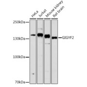 Western blot analysis of various lysates using GIGYF2 Antibody at 1/1000 dilution. Secondary antibody: HRP-conjugated Goat anti-Rabbit IgG (H+L) at 1/10000 dilution. Lysates/proteins: 25 µg per lane. Blocking buffer: 3% nonfat dry milk in TBST. Exposure time: 10s.