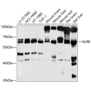 Western blot analysis of various lysates using GLRB Antibody at 1/1000 dilution. Secondary antibody: HRP-conjugated Goat anti-Rabbit IgG (H+L) at 1/10000 dilution. Lysates/proteins: 25 µg per lane. Blocking buffer: 3% nonfat dry milk in TBST. Exposure time: 10s.