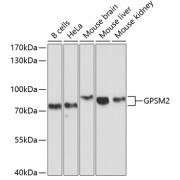 Western blot analysis of various lysates using GPSM2 Antibody at 1/1000 dilution. Secondary antibody: HRP-conjugated Goat anti-Rabbit IgG (H+L) at 1/10000 dilution. Lysates/proteins: 25 µg per lane. Blocking buffer: 3% nonfat dry milk in TBST. Exposure time: 10s.