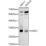 Western blot analysis of various lysates, using HES1 Antibody at 1/1000 dilution. Secondary antibody: HRP-conjugated Goat anti-Rabbit IgG (H+L) at 1/10000 dilution. Lysates/proteins: 25 µg per lane. Blocking buffer: 3% nonfat dry milk in TBST. Exposure time: 180s.