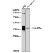 Western blot analysis of various lysates using HLA-DRA Antibody at 1/1000 dilution. Secondary antibody: HRP-conjugated Goat anti-Rabbit IgG (H+L) at 1/10000 dilution. Lysates/proteins: 25 µg per lane. Blocking buffer: 3% nonfat dry milk in TBST. Exposure time: 90s.